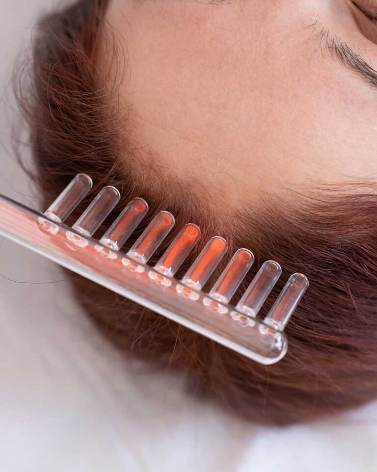 Terapia Capilar